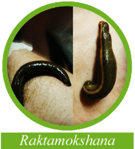Raktamokshana